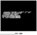Fig. 16 - METHOD FOR SIMULTANEOUS IMAGING AND IMAGE PROCESSING OF NEUROMELANIN AND NIGROSOME 1 USING 3D MULTI-ECHO GRE