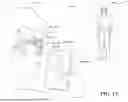Fig. 02 - Systems and Methods for Displaying Augmented Anatomical Features