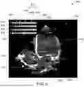 Fig. 07 - SYSTEM AND METHOD FOR SITUATIONAL AWARENESS IN CARDIAC CATHERIZATION
