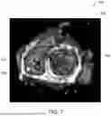 Fig. 08 - SYSTEM AND METHOD FOR SITUATIONAL AWARENESS IN CARDIAC CATHERIZATION