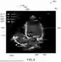 Fig. 09 - SYSTEM AND METHOD FOR SITUATIONAL AWARENESS IN CARDIAC CATHERIZATION