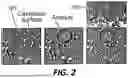 Fig. 03 - PROTEIN BIOSENSOR SYSTEMS TO DETECT MUTATED COVID FROM SPUTUM AND BLOOD
