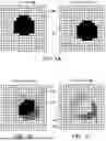 Fig. 02 - VIDEO COMPRESSION TECHNIQUES FOR RELIABLE TRANSMISSION