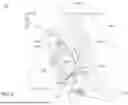 Fig. 04 - STEERING ARM RETURN TO NEUTRAL MECHANISM