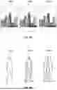 Fig. 17 - SYSTEMS AND METHODS FOR SIMULATING VISUAL ANOMALIES TO DIAGNOSE OCULAR CONDITIONS