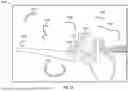 Fig. 20 - SYSTEMS AND METHODS FOR EXAMINING TEAR FILM QUALITY USING HIGH-RESOLUTION IMAGERY