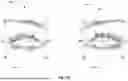 Fig. 18 - SYSTEMS AND METHODS FOR ASSESSING EYE COORDINATION THROUGH EYE-TRACKING EXERCISES