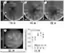 Fig. 06 - LASER-SPECKLE CONTRAST IMAGING SYSTEM AND METHOD