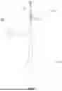 Fig. 06 - MULTI-CHANNEL PULSE HIGH-VOLTAGE PARAMETER-CONTROLLABLE SHOCK WAVE LITHOTRIPSY BALLOON IMAGING SYSTEM AND CATHETER THEREOF