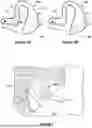 Fig. 04 - DEVICES, METHODS AND SYSTEMS FOR EAR-BASED PHOTOACOUSTIC PLETHYSMOGRAPHY