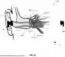 Fig. 07 - USING EAR-WORN DEVICES TO DETECT AIRWAY OBSTRUCTIONS AND OTHER PATHOLOGIES
