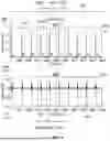 Fig. 09 - METHODS AND SYSTEMS FOR USING SEISMOCARDIOGRAPHY-BASED ALGORITHM FOR MONITORING HEART VALVE OPERATION
