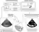 Fig. 01 - SYSTEMS AND METHODS FOR VOLUME-BASED ULTRASOUND GUIDANCE AND IMAGE ANALYSIS