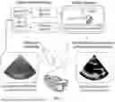 Fig. 02 - SYSTEMS AND METHODS FOR VOLUME-BASED ULTRASOUND GUIDANCE AND IMAGE ANALYSIS