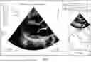 Fig. 07 - SYSTEMS AND METHODS FOR VOLUME-BASED ULTRASOUND GUIDANCE AND IMAGE ANALYSIS