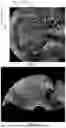 Fig. 04 - METHOD, APPARATUS AND ULTRASOUND IMAGING SYSTEM FOR GENERATING THREE-DIMENSIONAL ULTRASOUND MODEL
