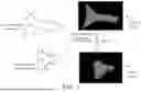 Fig. 07 - METHOD, APPARATUS AND ULTRASOUND IMAGING SYSTEM FOR GENERATING THREE-DIMENSIONAL ULTRASOUND MODEL