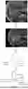 Fig. 08 - METHOD, APPARATUS AND ULTRASOUND IMAGING SYSTEM FOR GENERATING THREE-DIMENSIONAL ULTRASOUND MODEL