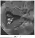Fig. 12 - METHOD, APPARATUS AND ULTRASOUND IMAGING SYSTEM FOR GENERATING THREE-DIMENSIONAL ULTRASOUND MODEL