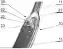 Fig. 01 - SURGICAL INSTRUMENT FOR ENHANCED VISUALIZATION IN MINIMALLY INVASIVE SURGERY AND A SURGICAL SYSTEM