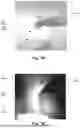 Fig. 04 - SURGICAL INSTRUMENT FOR ENHANCED VISUALIZATION IN MINIMALLY INVASIVE SURGERY AND A SURGICAL SYSTEM