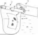 Fig. 01 - RETRIEVE DEVICE AND METHOD FOR RETRIEVING TISSUE