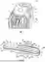 Fig. 02 - SYSTEM FOR LEFT ATRIAL APPENDAGE CLIP