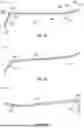 Fig. 72 - SYSTEM FOR LEFT ATRIAL APPENDAGE CLIP