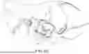 Fig. 32 - CARDIAC RETRACTOR