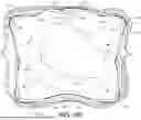 Fig. 33 - CARDIAC RETRACTOR