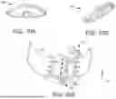 Fig. 49 - CARDIAC RETRACTOR