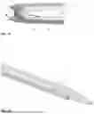 Fig. 08 - RETRACTOR SYSTEM FOR SPINE SURGERY