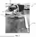 Fig. 02 - TISSUE RETRACTION DEVICES, SYSTEMS, AND METHODS