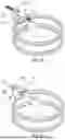 Fig. 04 - DEVICE FOR SUPPORTING AND POSITIONING A SURGICAL RETRACTOR BLADE ON A RING RETRACTOR