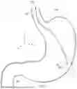 Fig. 02 - SYSTEMS AND METHODS FOR ENDOSCOPIC TISSUE GRASPING