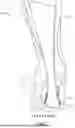 Fig. 02 - MINIMALLY INVASIVE SURGICAL METHOD FOR HAGLUND'S DEFORMITY AND PARATENON PRESERVATION