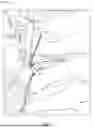Fig. 06 - MINIMALLY INVASIVE SURGICAL METHOD FOR HAGLUND'S DEFORMITY AND PARATENON PRESERVATION