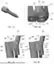 Fig. 07 - SYSTEMS AND METHODS FOR TRANSCORPOREAL MICRODECOMPRESSION