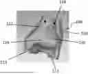 Fig. 01 - PATIENT-SPECIFIC TEMPLATE FOR TOTAL ANKLE REPLACEMENT