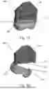 Fig. 08 - PATIENT-SPECIFIC TEMPLATE FOR TOTAL ANKLE REPLACEMENT