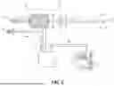Fig. 02 - CATHETER SYSTEM FOR TREATING THROMBOEMBOLIC DISEASE HAVING DEEP PULSATILE SUCTION WITH DIFFERENTIAL FLOW AND METHOD OF USING SAME