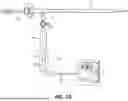 Fig. 08 - CATHETER SYSTEM FOR TREATING THROMBOEMBOLIC DISEASE HAVING DEEP PULSATILE SUCTION WITH DIFFERENTIAL FLOW AND METHOD OF USING SAME