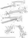 Fig. 02 - SURGICAL GUIDE