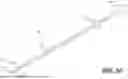 Fig. 09 - PERCUTANEOUS LATERAL RECESS RESECTION METHODS AND INSTRUMENTS
