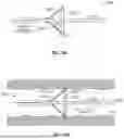 Fig. 22 - POSTPARTUM UTERINE HEMORRHAGE DEVICE