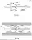 Fig. 23 - POSTPARTUM UTERINE HEMORRHAGE DEVICE