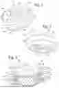 Fig. 02 - MEDICAL IMPLANT THREADED PLUG HAVING A START STRUCTURE