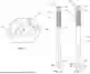 Fig. 07 - SYSTEMS AND METHODS FOR CORRECTING SPINAL CURVATURE AND ASSOCIATED INSTRUMENTS