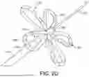 Fig. 06 - PFA ABLATION CATHETER HAVING SENSING AND MAPPING CAPABILITY