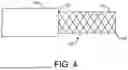 Fig. 05 - CONDUCTIVE MEMBER TO PROMOTE INSULATIVE MEDIUM FORMATION FOR FACILITATING TISSUE PUNCTURE IN A LIQUID MEDIUM